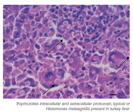 Protozoal diseases