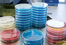 Major histocompatibility complex and genetic resistance to Infectious Bronchitis Virus