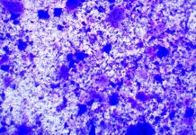 Evaluation of anti-inflammatory capacities of bacillus-based probiotics using an in vitro intestinal cell model