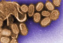 H7N9 flu mutation identified that allows immune system escape