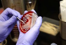 Investigating diseases affecting poultry production