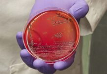 Pathogenesis of egg infections by salmonella – Second Part