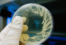 Avian influenza in Europe: enhanced surveillance and strict biosecurity needed as detections surge