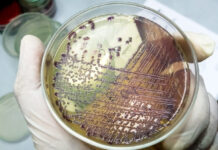 Practical guide for evaluating day-old chick quality: key standards and health monitoring