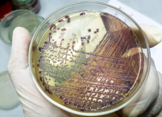 Practical guide for evaluating day-old chick quality: key standards and health monitoring