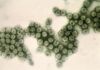 Serious Listeria infections rising in Europe, EU report warns