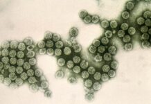 Serious Listeria infections rising in Europe, EU report warns