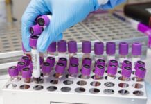 Foodborne zoonoses on the rise – Poultry sector implications