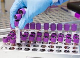 Foodborne zoonoses on the rise – Poultry sector implications