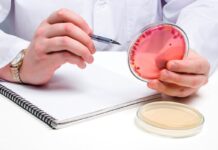 Beyond detection: how to interpret Salmonella results in breeder flocks and egg production