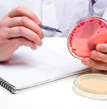 Beyond detection: how to interpret Salmonella results in breeder flocks and egg production